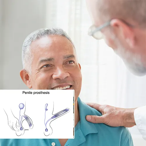 Life with a Penile Implant